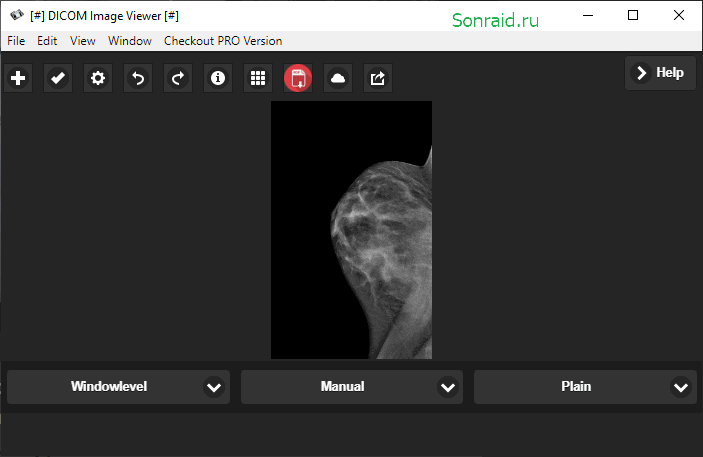 DICOM Image Viewer 1.0.1